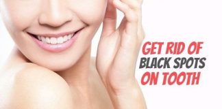How to Get Rid of Black Spots on Tooth