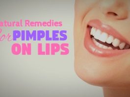Excellent Home Remedies for Pimples on Lips That Work