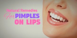 Excellent Home Remedies for Pimples on Lips That Work