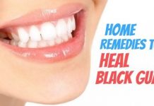 10 Promising Remedies to Heal Black Gums Naturally