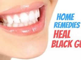 10 Promising Remedies to Heal Black Gums Naturally