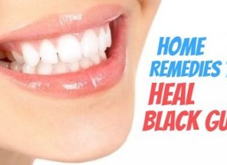 10 Promising Remedies to Heal Black Gums Naturally