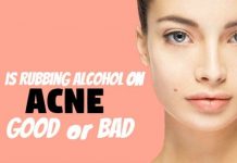 is Rubbing Alcohol for Acne Good or Bad