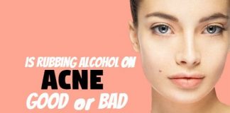 is Rubbing Alcohol for Acne Good or Bad