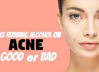 is Rubbing Alcohol for Acne Good or Bad