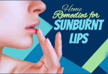 Home Remedies for Sunburnt Lips