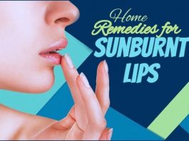 Home Remedies for Sunburnt Lips