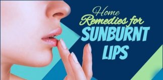 Home Remedies for Sunburnt Lips