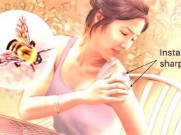 Remedies For Bee Stings