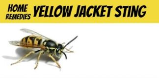 Home Remedies For Yellow Jacket Sting 