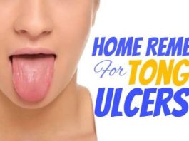 Remedies To Ease Your Tongue Ulcers