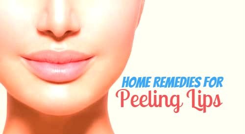 get-rid-of-peeling-lips-naturally-best-home-remedies