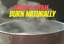 How To Treat A Steam Burn Naturally