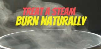 How To Treat A Steam Burn Naturally