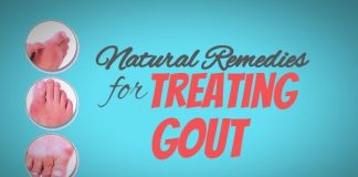 Natural Remedies for Treating Gout