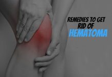 Remedies To Get Rid Of Hematoma