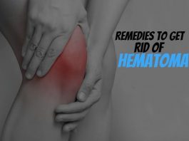 Remedies To Get Rid Of Hematoma