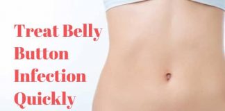 Treat Belly Button Infection naturally home