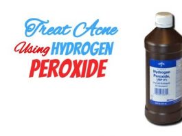 Treating Acne Using Hydrogen Peroxide