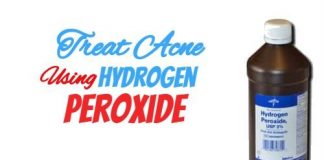 Treating Acne Using Hydrogen Peroxide