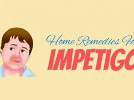 Remedies for Treating Impetigo At Home