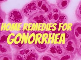 Home Remedies for Gonorrhea