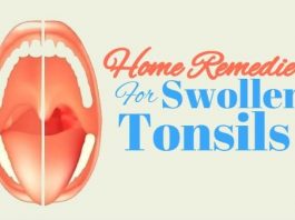 home remedies to getr rid of swollen tonsils