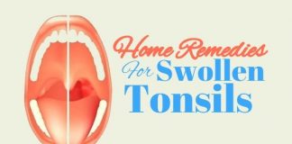 home remedies to getr rid of swollen tonsils